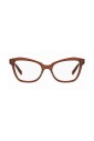 montures-en-acetate-jaune-lunettes